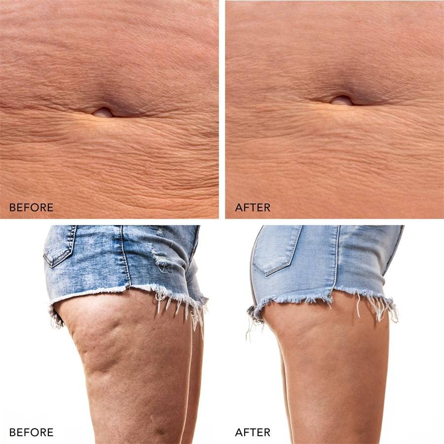 Foreo Body Bis zu 50% Rabatt