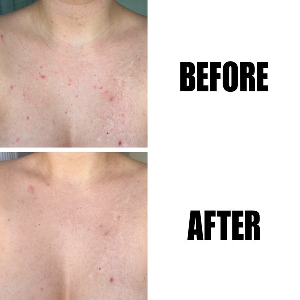 The INKEY List Glycolic Acid Exfoliating Body Stick 45g Tägliche Deals