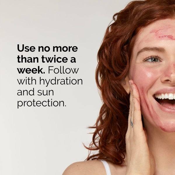The Ordinary AHA 30% + BHA 2% Peeling Solution 30ml Saisonschlussverkauf