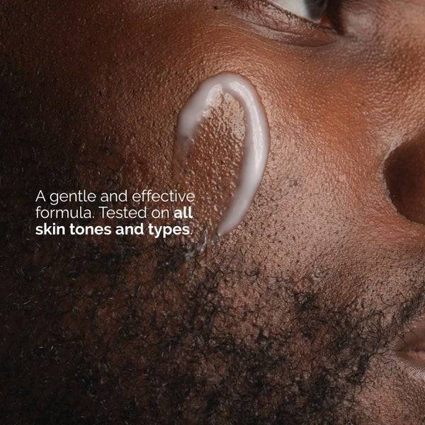 The Ordinary Niacinamide 5% Face and Body Emulsion 100ml Räumungsverkauf