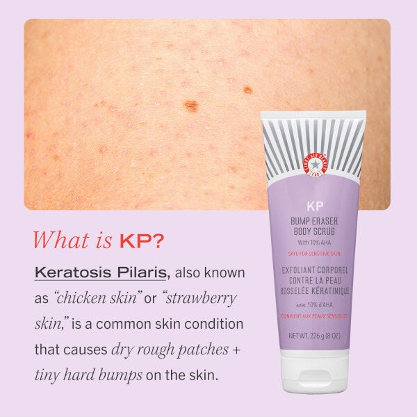 First Aid Beauty KP Bump Eraser Body Scrub with 10% AHA 226g Black Friday Preise