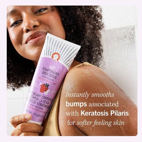 First Aid Beauty KP Bump Eraser Fresh Strawberry Body Scrub with 10% AHA 226g Auslauf