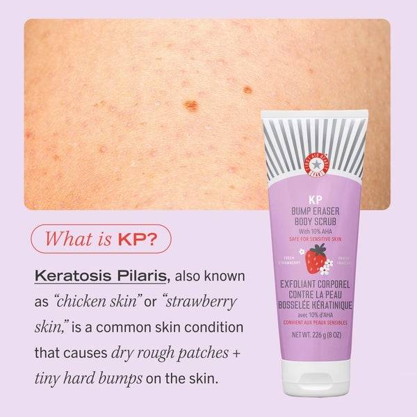 First Aid Beauty KP Bump Eraser Fresh Strawberry Body Scrub with 10% AHA 226g Auslauf