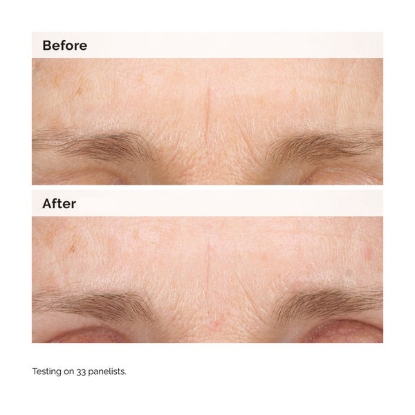 The Ordinary Retinal 0.2% Emulsion 15ml Speichern exportieren