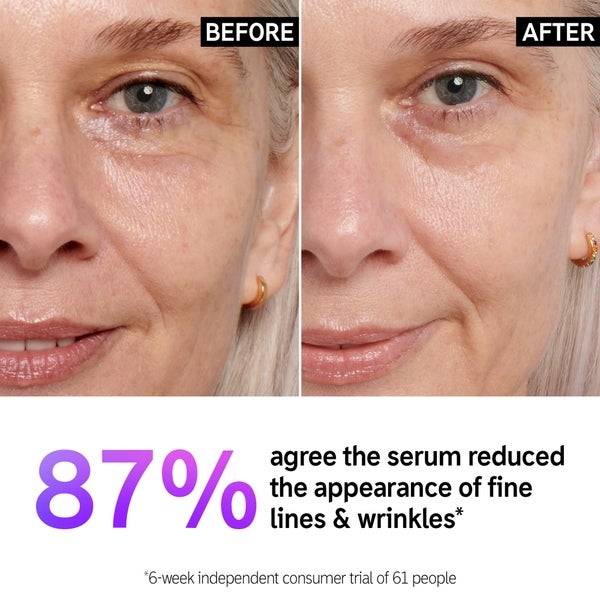The INKEY List Retinol Serum 30ml Outlet