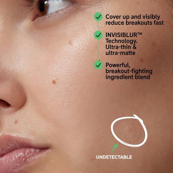 The INKEY List Hydrocolloid Invisible Pimple Patches Angebote