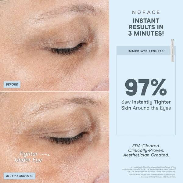 NuFACE FIX Line Smoothing Device Vierteljährliche Förderung