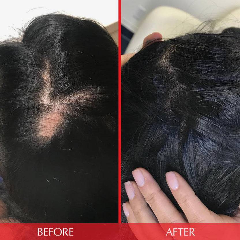 HAIRtamin HAIRtamin Advanced Formula 1 Month Outlet