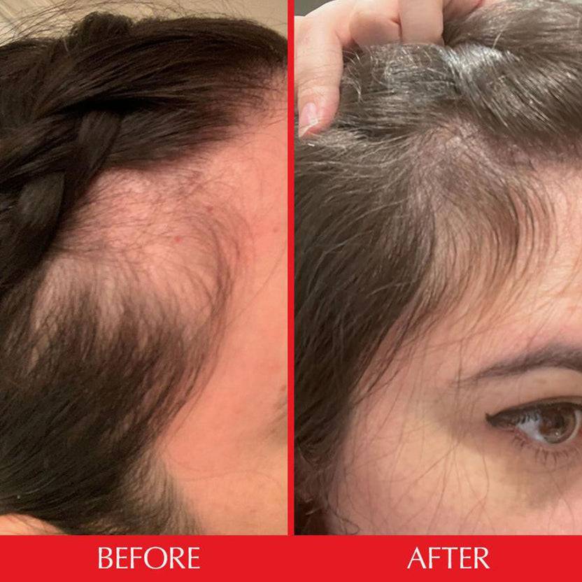 HAIRtamin Gummy Stars™ 1 Month Jubiläumsangebot