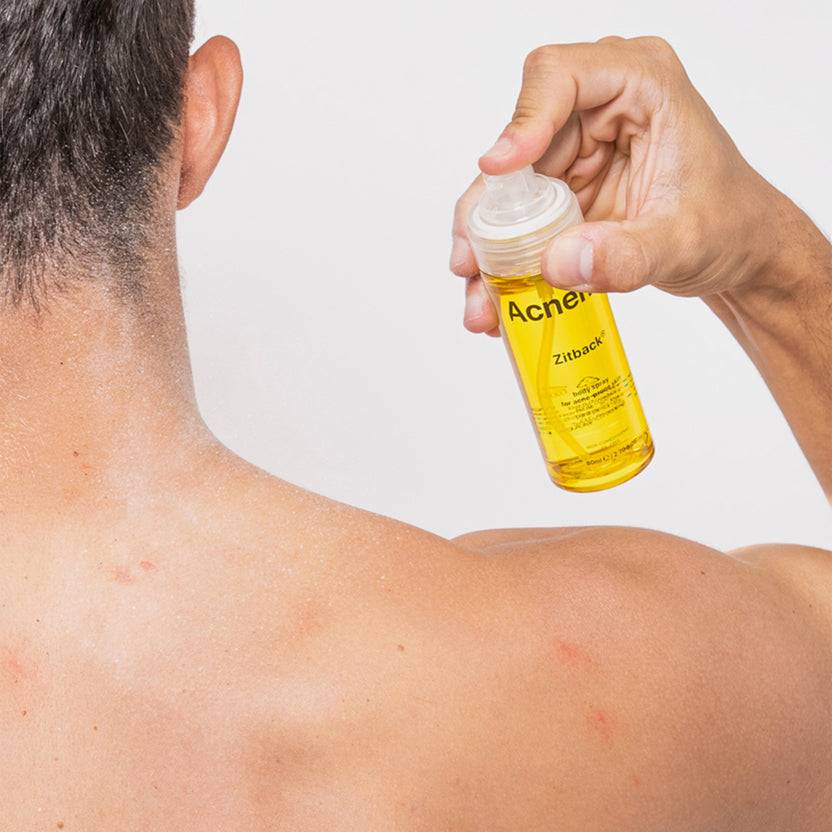 Acnemy Zitback® (80ml) Fabrikladen