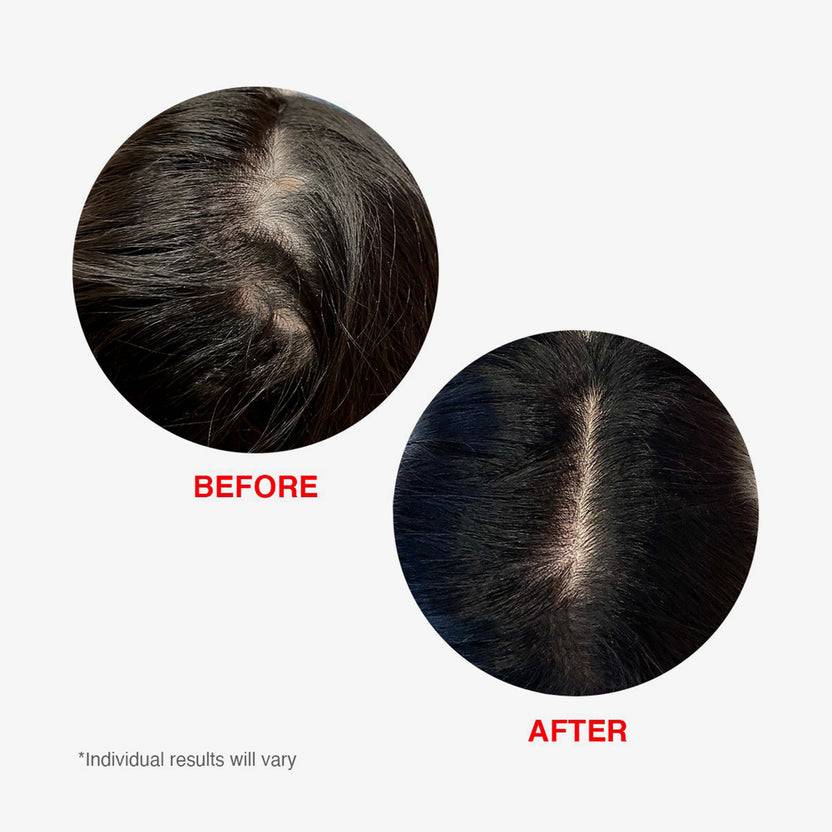 HAIRtamin Scalp Serum (60ml) Günstiger Verkauf