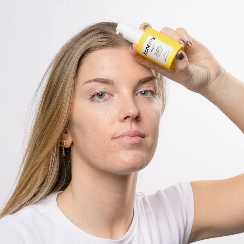 Acnemy Zitcalm Serum (30ml) Zeitbegrenzte Promotion