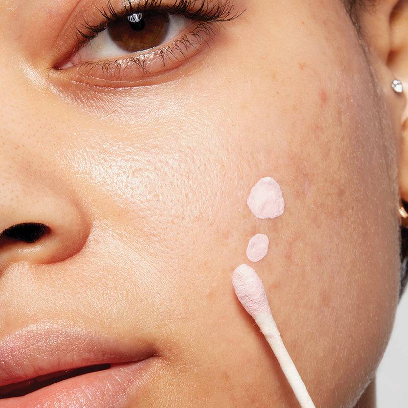 Mario Badescu Acne Control Nur für heute