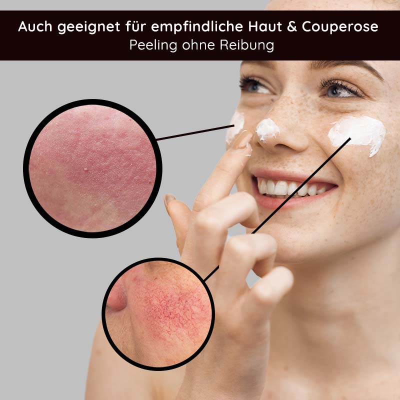 Rau Cosmetics Fruit Acid Peeling 100 ml Fruchtsäurepeeling mit BHA Begrenzte Freigabe