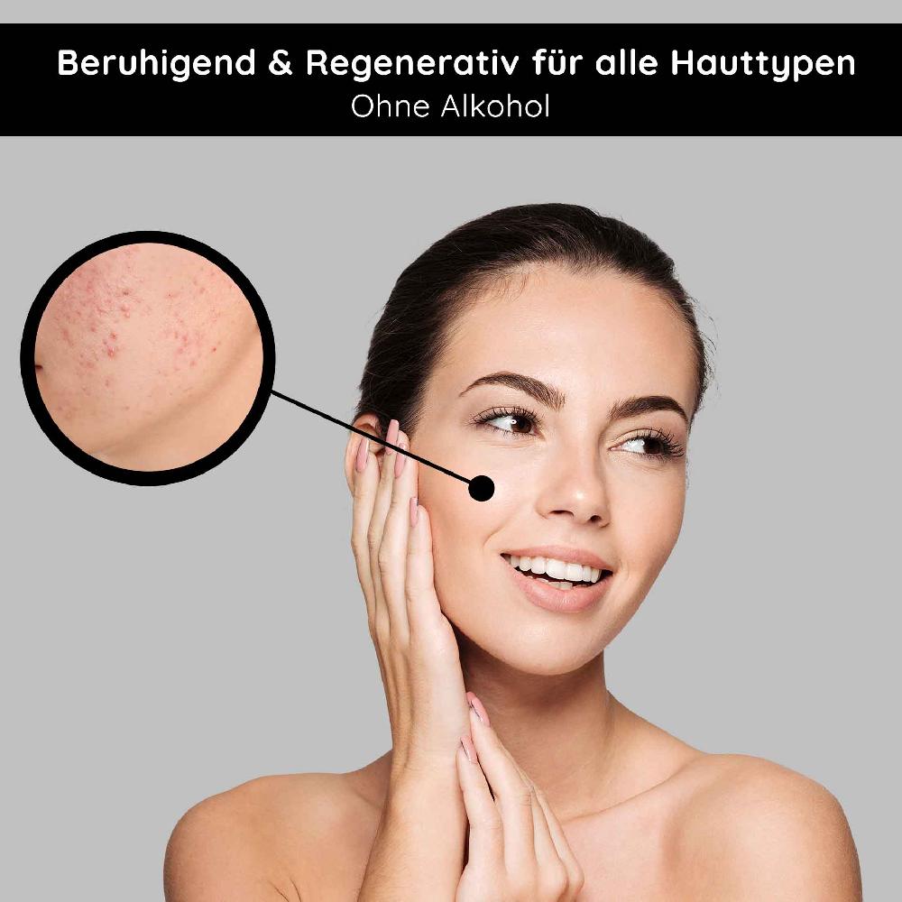 Rau Cosmetics Tonic alcohol-free 200 ml mit Brennnessel-Extrakt Letzte 2 Tage